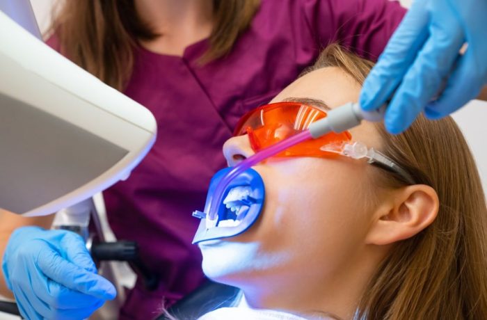 Teeth Whitening at Home What Works, What to Avoid, and When to See an Idaho Falls Dentist