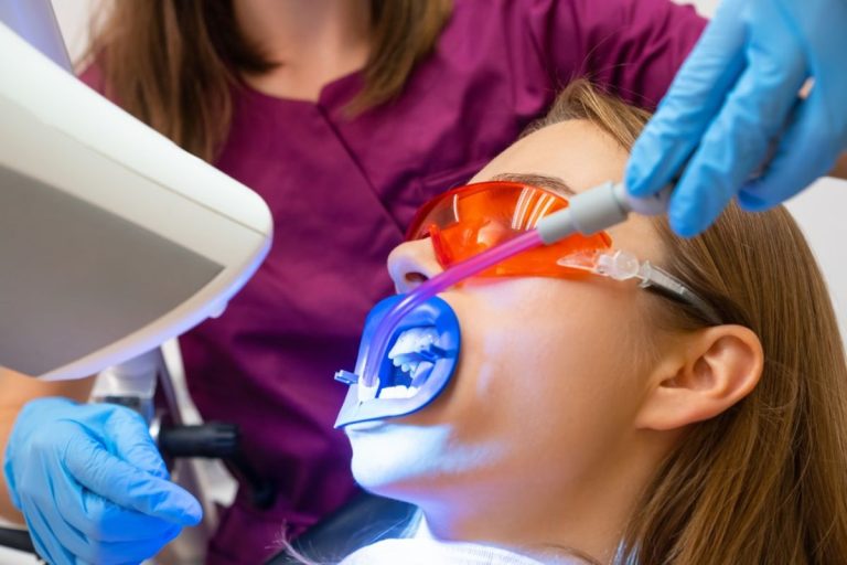 Teeth Whitening at Home What Works, What to Avoid, and When to See an Idaho Falls Dentist